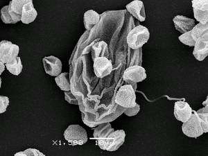 Didymium serpula - Сеть капиллиция с шаровидными пузыревидными вздутиями и спорами, СЭМ, Нелидовский, Tver Oblast (Russia)