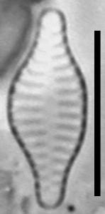 Масштаб - 10 мкм., Рузский район, Moscow Oblast (Russia)