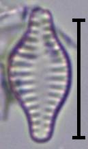 Масштаб - 10 мкм., Рузский район, Moscow Oblast (Russia)