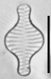 Масштаб - 10 мкм., Рузский район, Moscow Oblast (Russia)