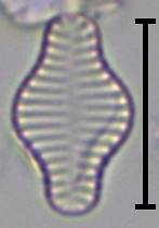 Масштаб - 10 мкм., Рузский район, Moscow Oblast (Russia)