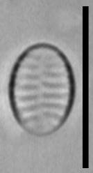 Масштаб - 10 мкм., Рузский район, Moscow Oblast (Russia)