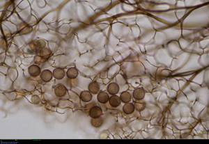Stemonitopsis amoena  - периферическая сеть капиллиция и споры в проходящем свете, Локнянский, Pskov Oblast (Russia)