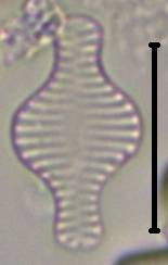 Масштаб - 10 мкм., Рузский район, Moscow Oblast (Russia)