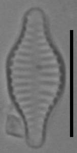 Масштаб - 10 мкм., Рузский район, Moscow Oblast (Russia)