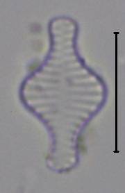 Масштаб - 10 мкм., Рузский район, Moscow Oblast (Russia)