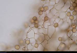 Stemonitis lignicola - периферическая сеть капиллиция и споры в проходящем свете, Бежаницкий, Pskov Oblast (Russia)