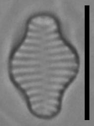 Масштаб - 10 мкм., Рузский район, Moscow Oblast (Russia)