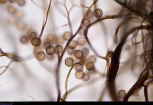 Stemonitopsis amoena - сеть капиллиция и споры в проходящем свете, Бежаницкий, Pskov Oblast (Russia)