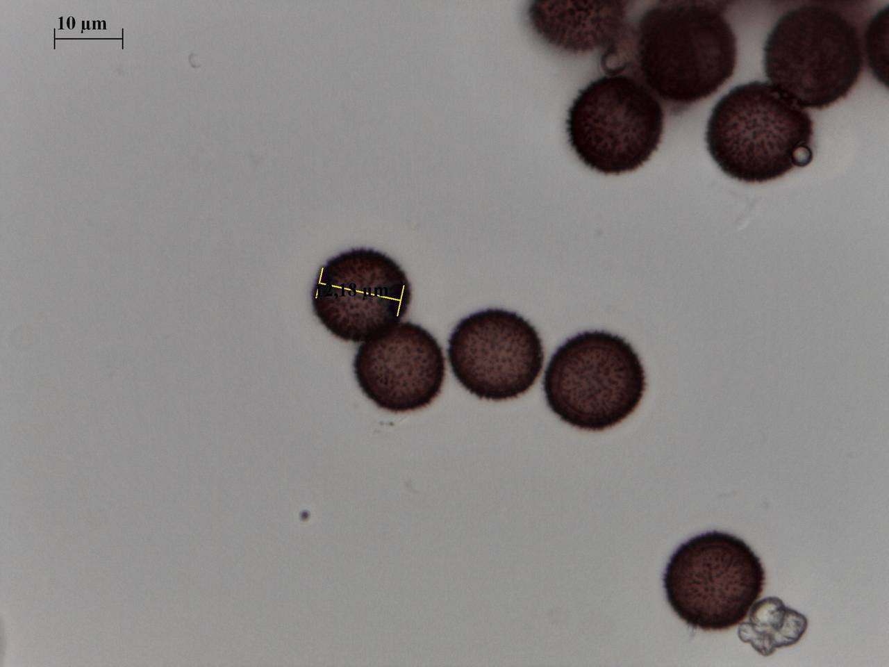 Diderma spumarioides - споры × 1000, Каневской, Krasnodar Krai (Russia)