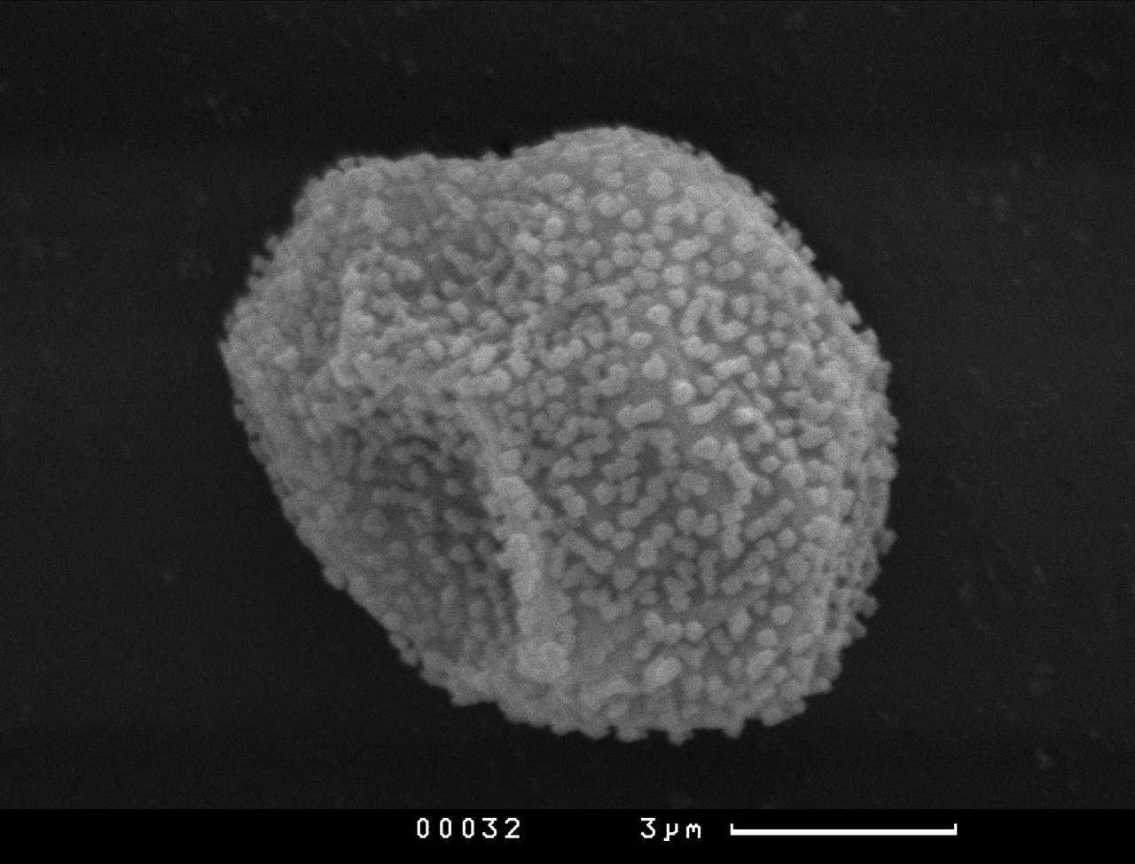 Perichaena vermicularis - Орнаментация нитей капиллиция, СЭМ, Vientiane Province (Laos)