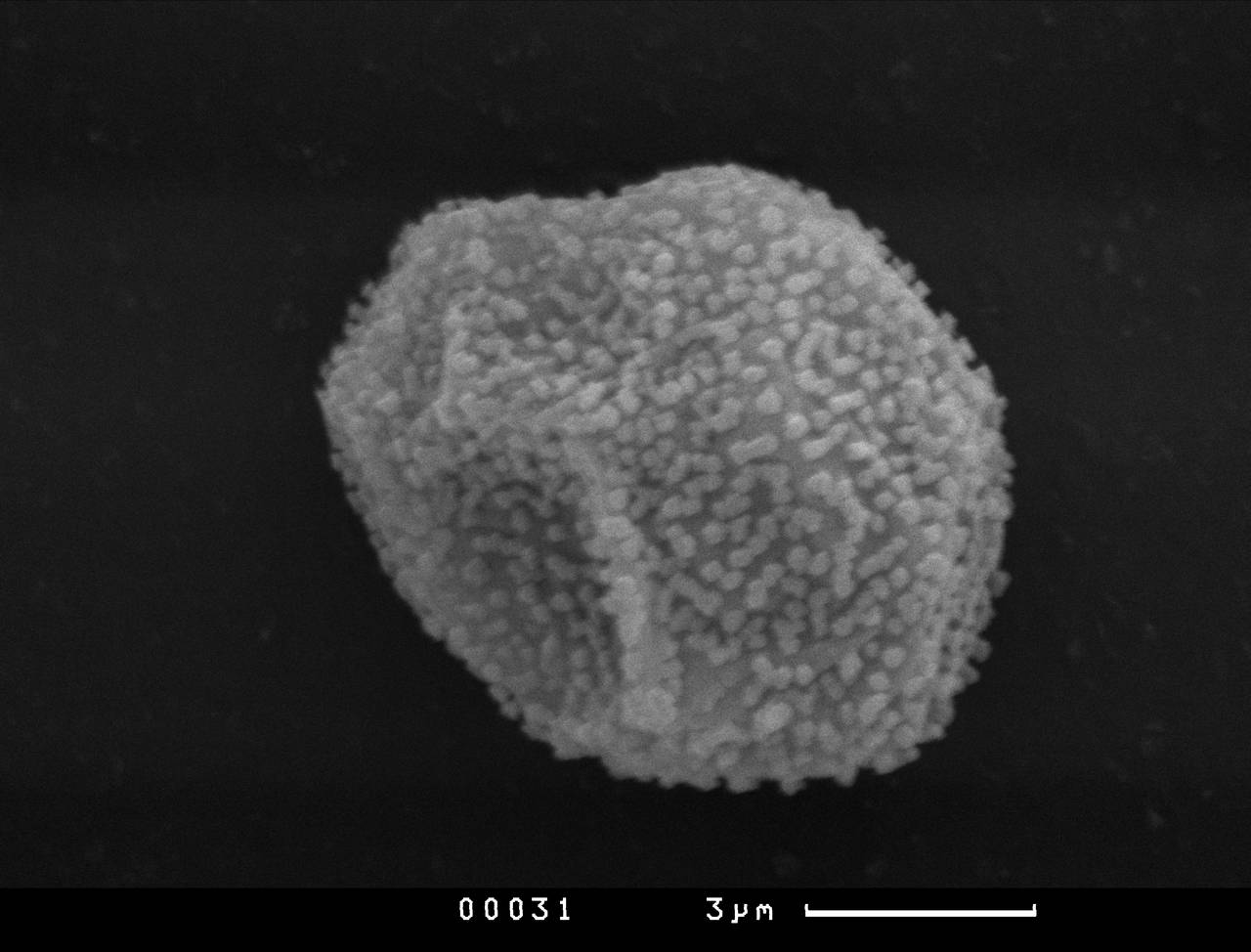 Perichaena vermicularis - Орнаментация нитей капиллиция, СЭМ, Vientiane Province (Laos)