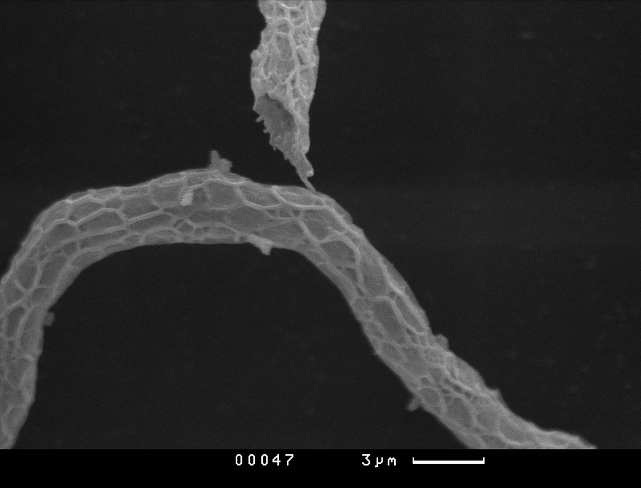 Perichaena quadrata - Спора, СЭМ, Vientiane Province (Laos)