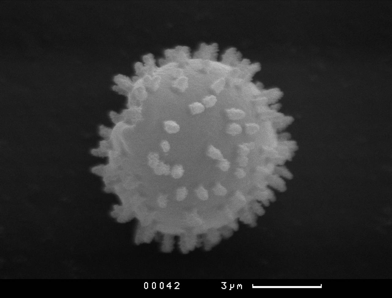 Perichaena quadrata - Спора, СЭМ, Vientiane Province (Laos)