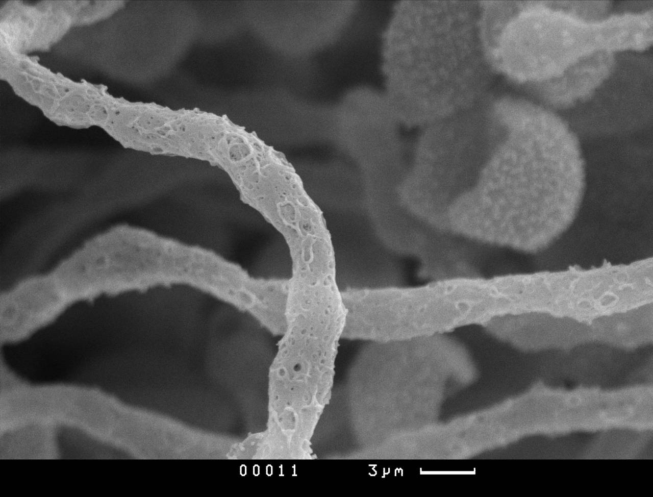 Perichaena pedata - Орнаментация нитей капиллиция, СЭМ, Vientiane Province (Laos)