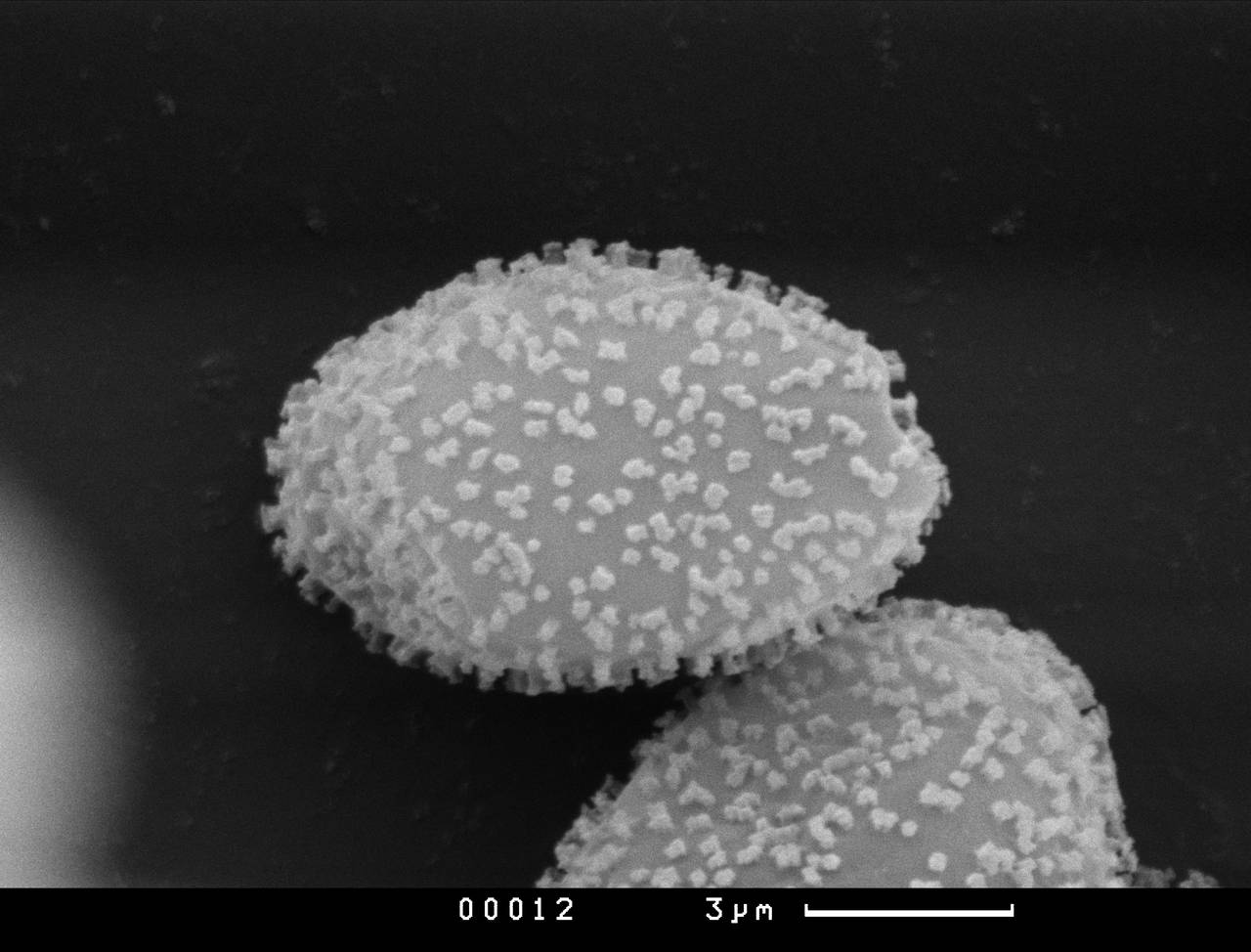 Perichaena pedata - Орнаментация нитей капиллиция, СЭМ, Vientiane Province (Laos)