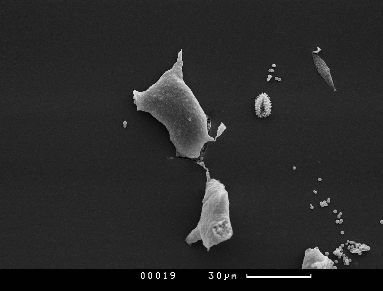 Physarum echinosporum - Узелки капиллиция, СЭМ, Vientiane Province (Laos)