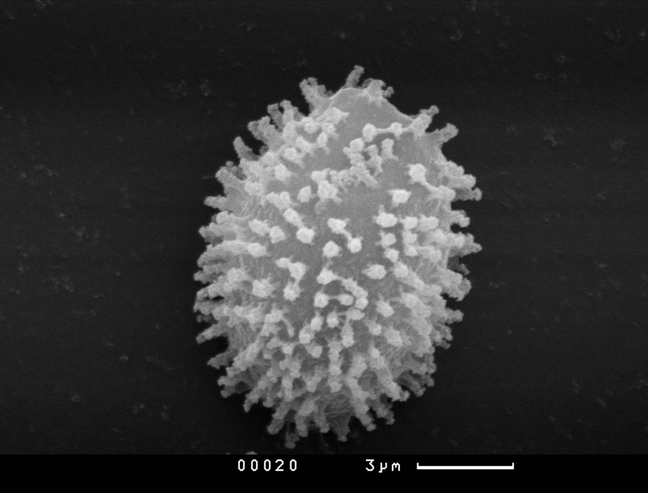 Physarum echinosporum - Узелки капиллиция, СЭМ, Vientiane Province (Laos)