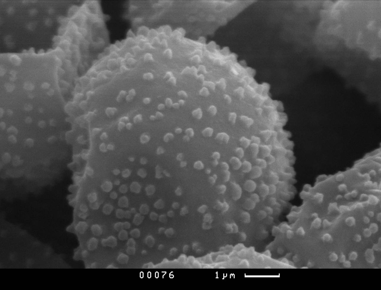 Diderma chondrioderma - Спора, СЭМ, Новороссийский, Krasnodar Krai (Russia)