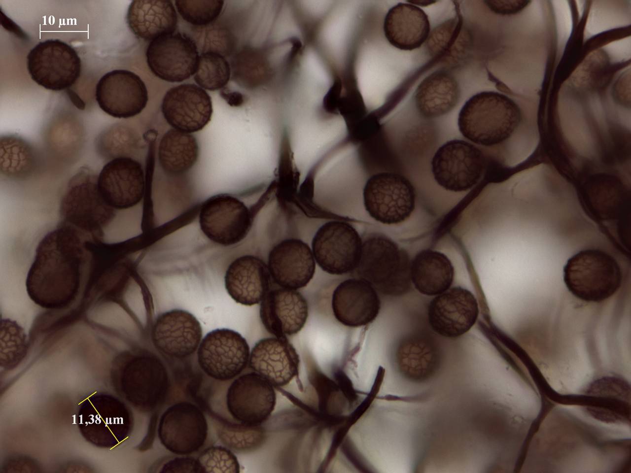 Symphytocarpus trechisporus - споры и капиллиций × 1000, Курский, Kursk Oblast (Russia)