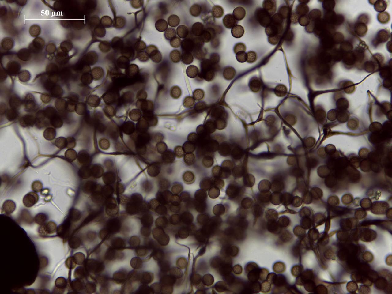 Symphytocarpus trechisporus - споры и капиллиций × 1000, Курский, Kursk Oblast (Russia)