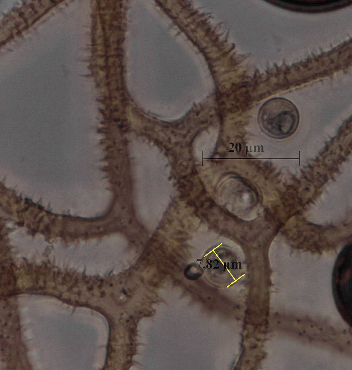 Arcyria cf. magna - капиллиций и споры × 1000, Лазовский, Primorsky Krai (Russia)