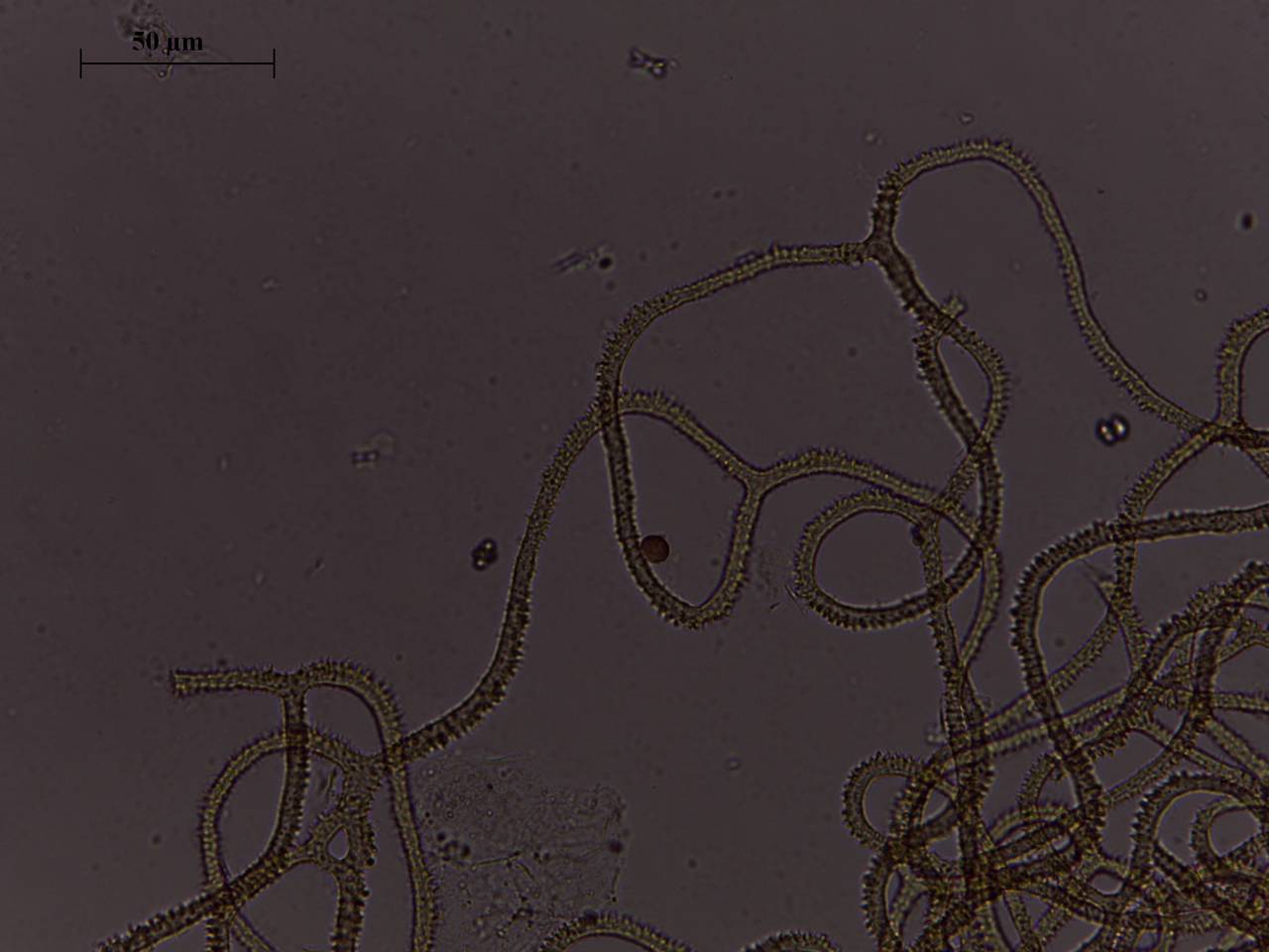 Arcyria cf. magna - капиллиций и споры × 1000, Лазовский, Primorsky Krai (Russia)