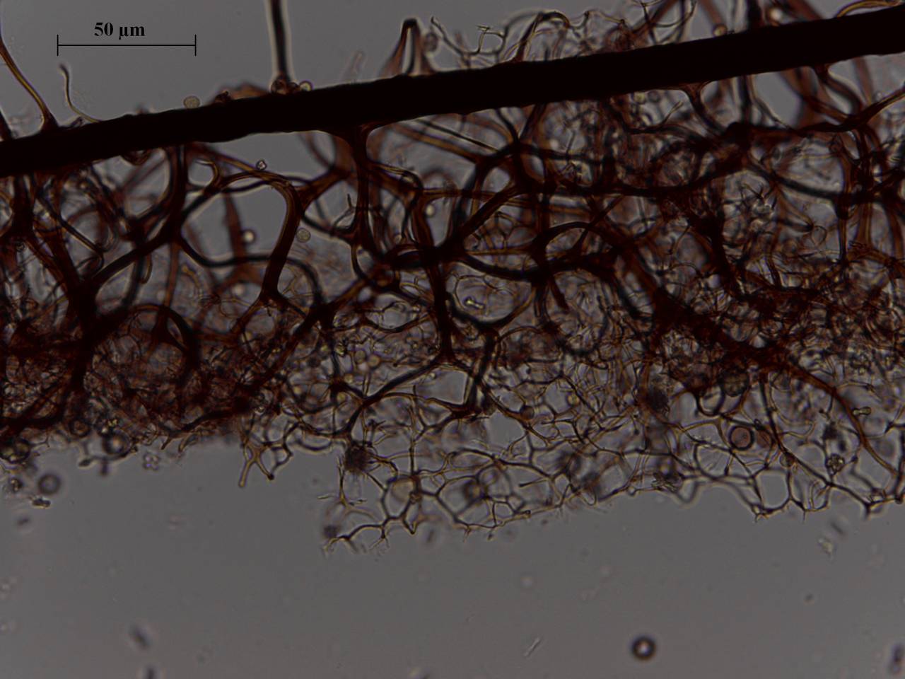 Stemonitopsis gracilis - споры и фрагмент капиллиция × 1000, Лазовский, Primorsky Krai (Russia)