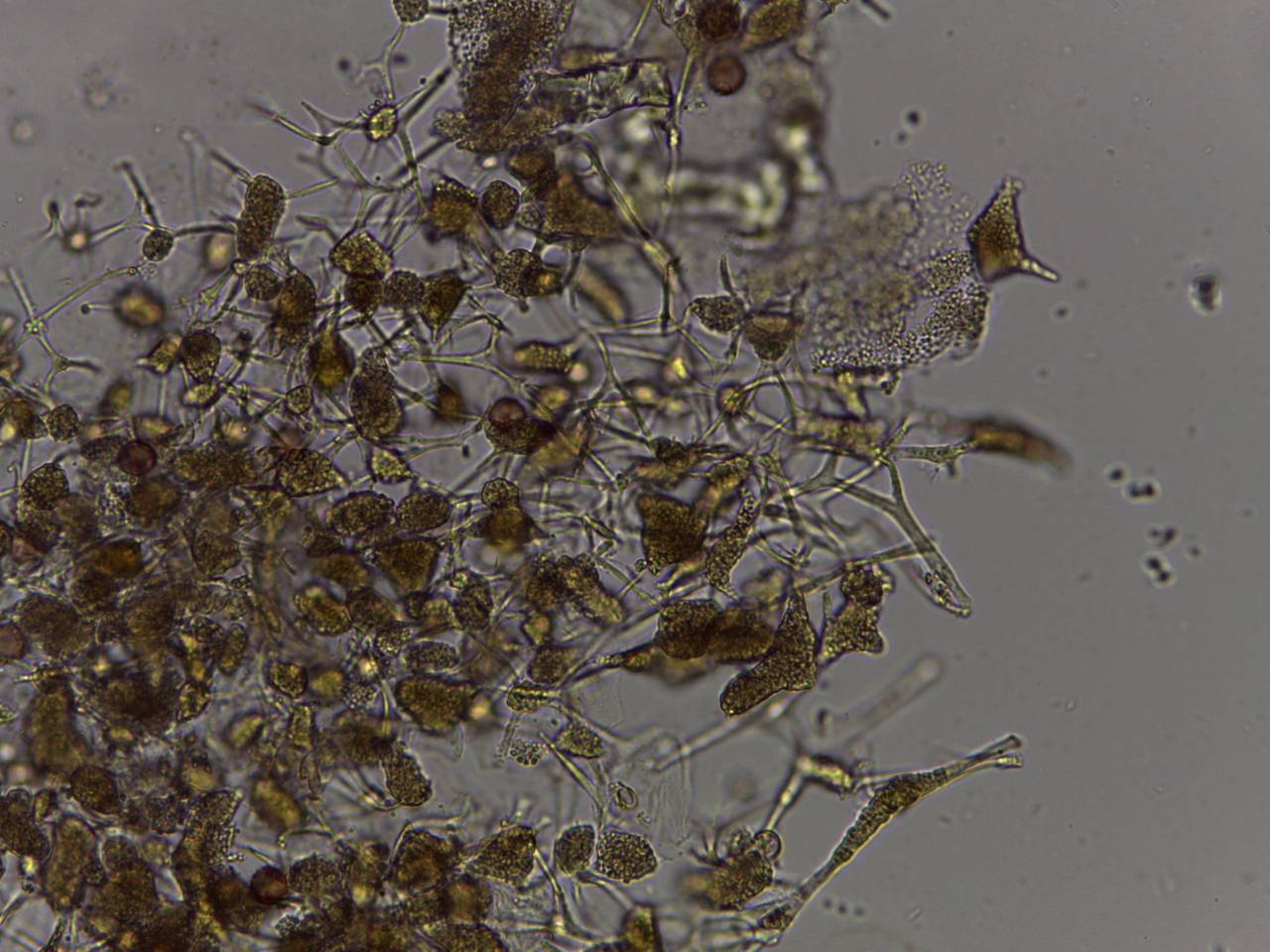 Physarum cf. auripigmentum  × 1000, Лазовский, Primorsky Krai (Russia)