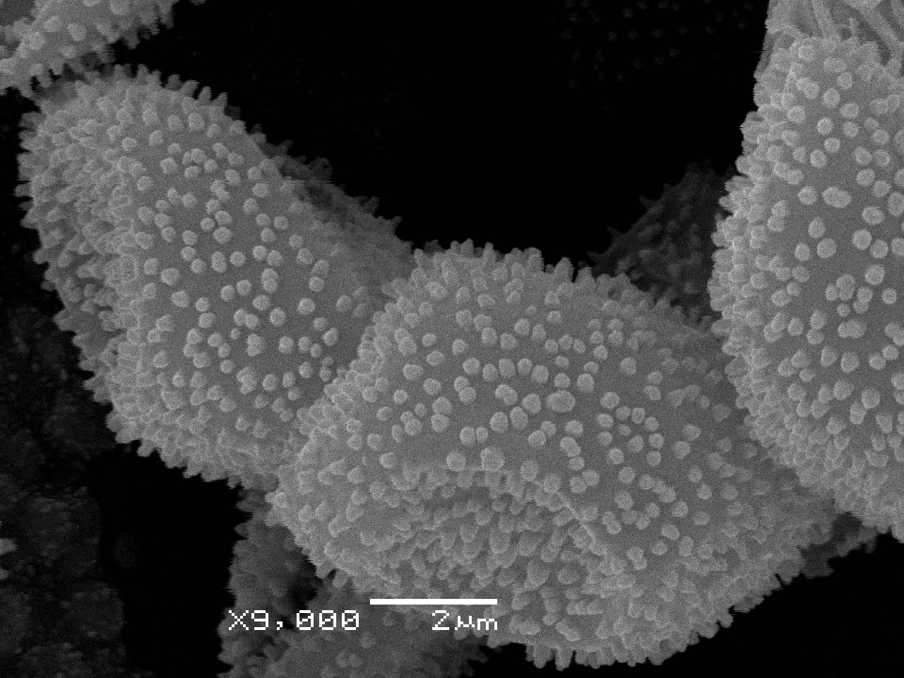 Physarum auripigmentum - Сеть капиллиция, СЭМ, Лазовский, Primorsky Krai (Russia)