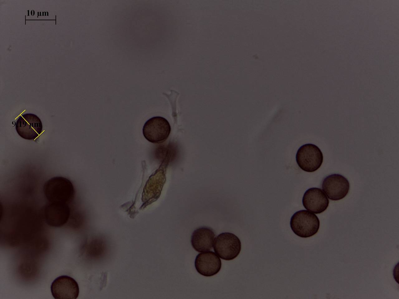 Physarum aurantium - споры × 1000, Лазовский, Primorsky Krai (Russia)