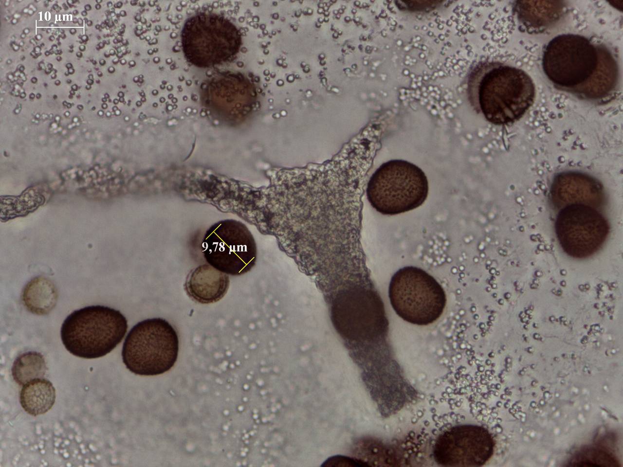 Badhamia capsulifera - споры и капиллиций × 1000, Лазовский, Primorsky Krai (Russia)