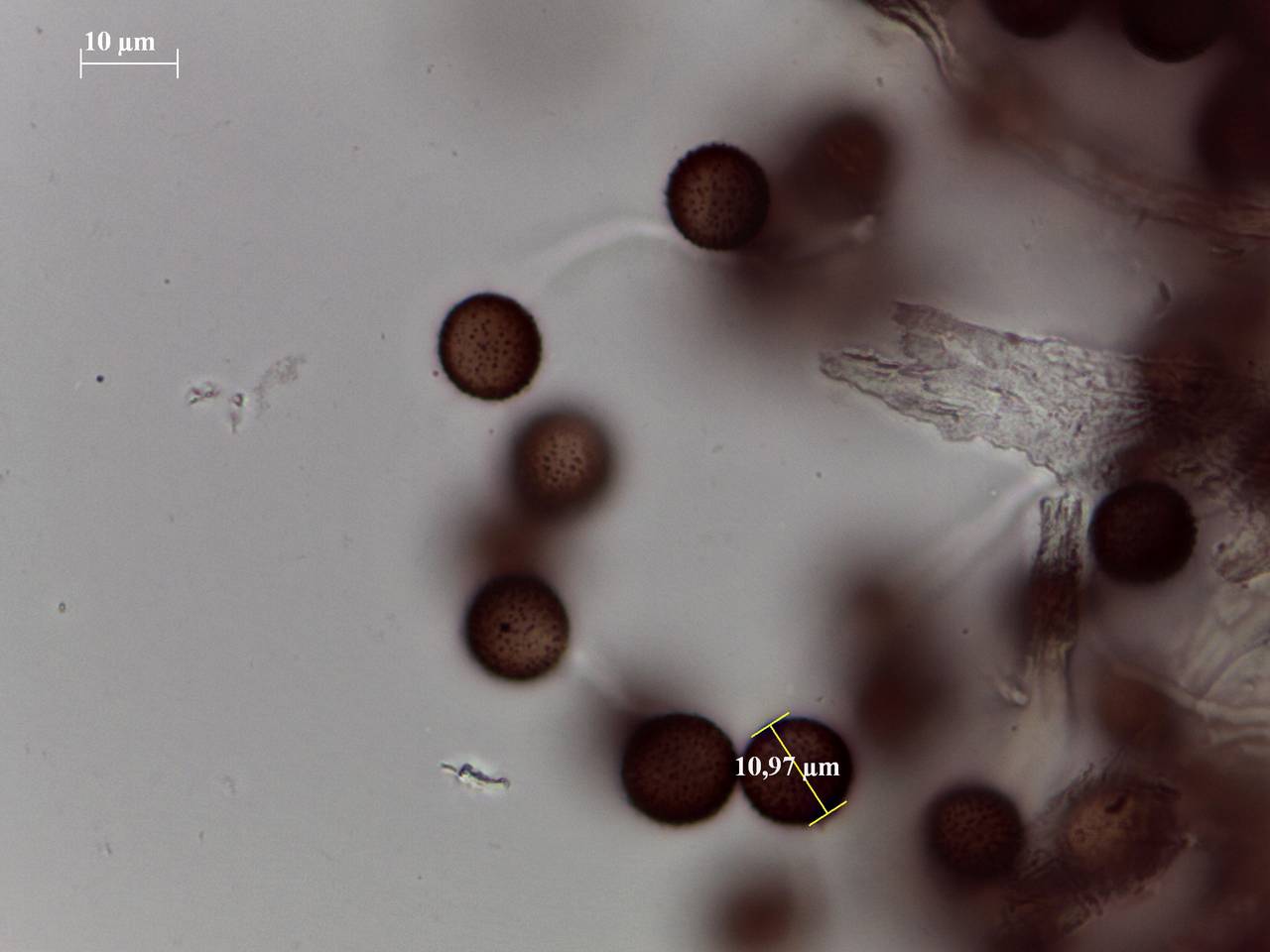 Badhamia foliicola - капиллиций и споры × 1000, Лазовский, Primorsky Krai (Russia)