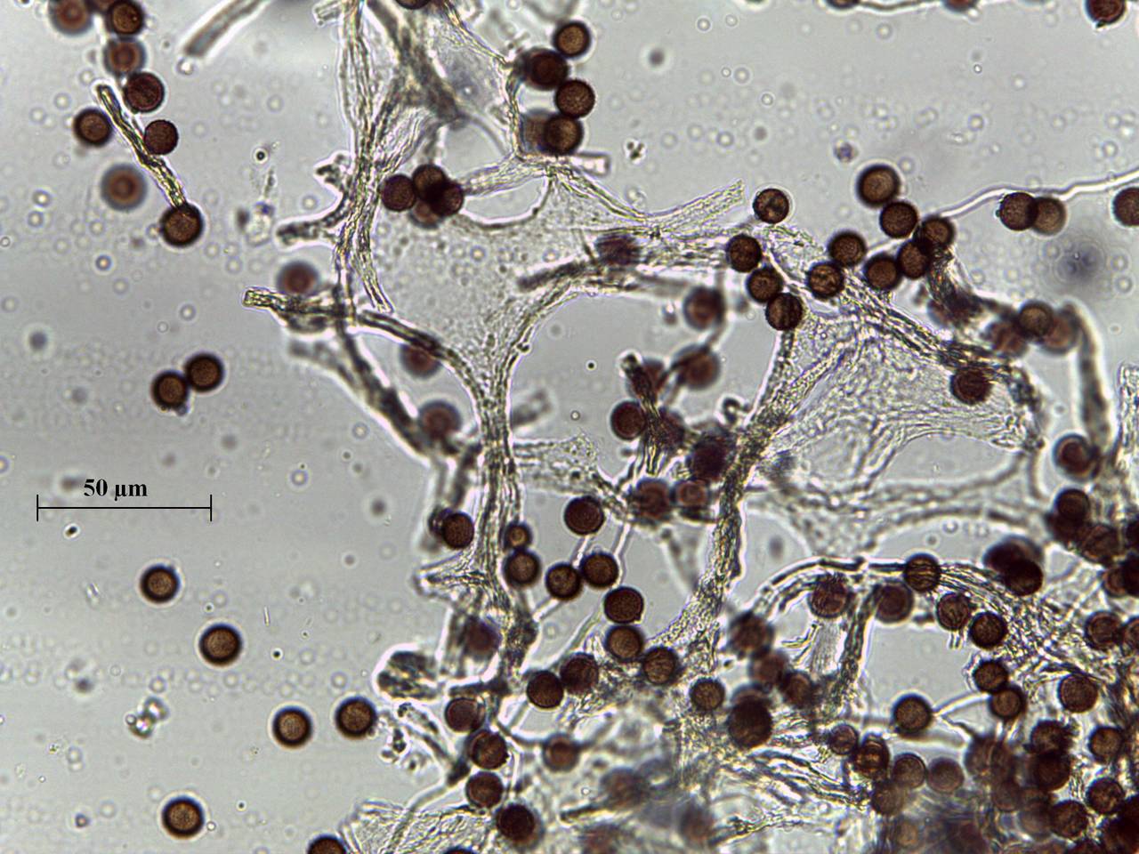 Badhamia foliicola - капиллиций и споры × 1000, Лазовский, Primorsky Krai (Russia)