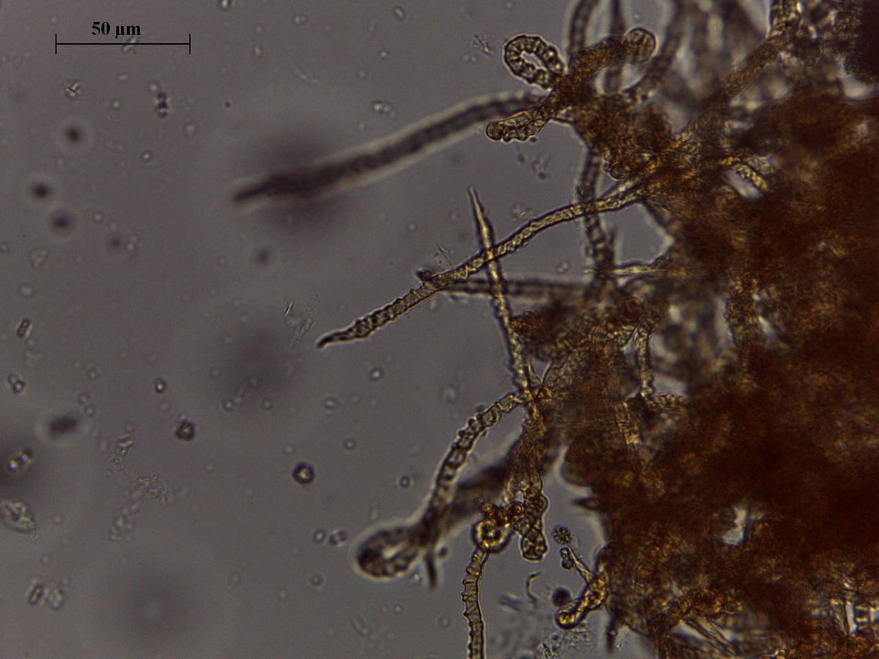 Trichia varia - капиллиций, споры × 400, Майкопский, Adygea (Russia)