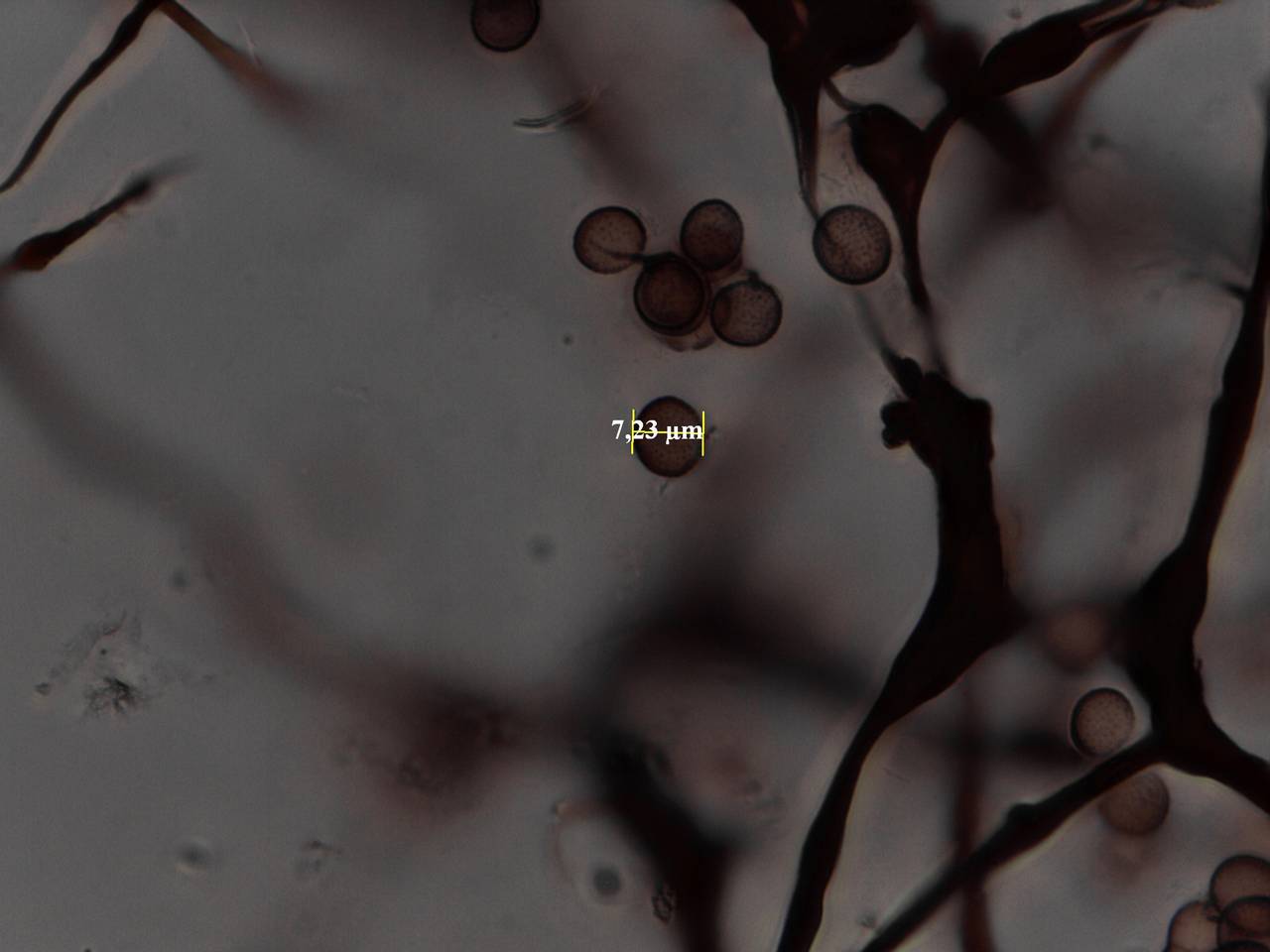 Symphytocarpus flaccidus - споры и капиллиций × 1000, Лоухский, Karelia (Russia)