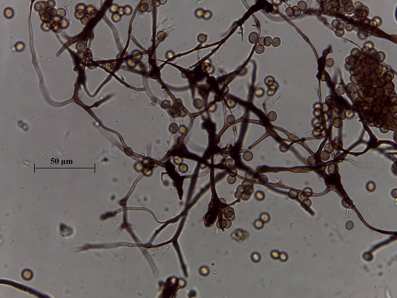 Symphytocarpus flaccidus - споры и капиллиций × 1000, Лоухский, Karelia (Russia)