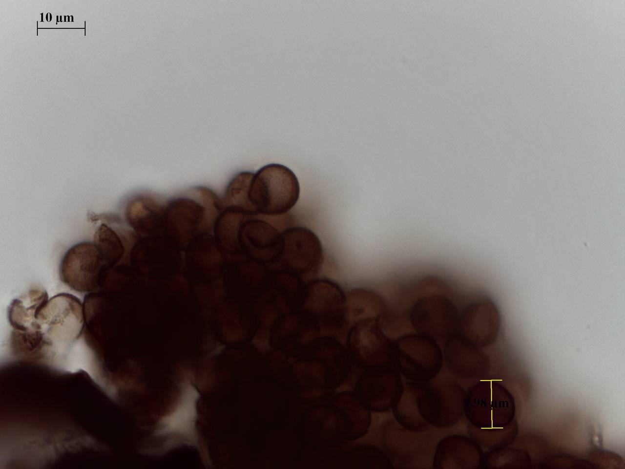 Symphytocarpus cf. flaccidus - споры × 1000 , Кандалакшский, Murmansk Oblast (Russia)