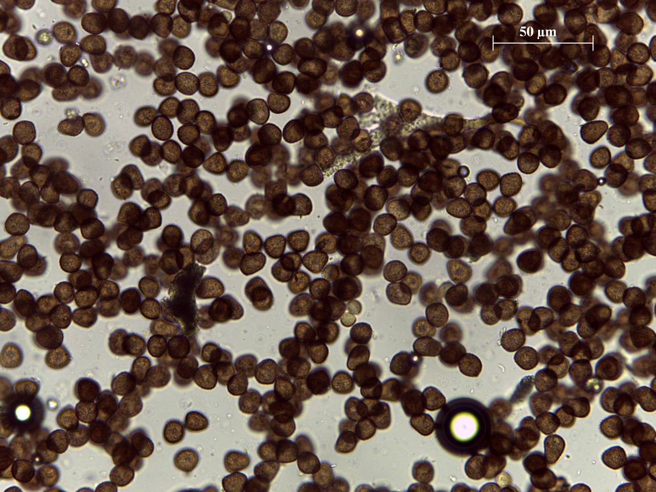 Badhamia capsulifera - споры и капиллиций × 400, Нелидовский, Tver Oblast (Russia)