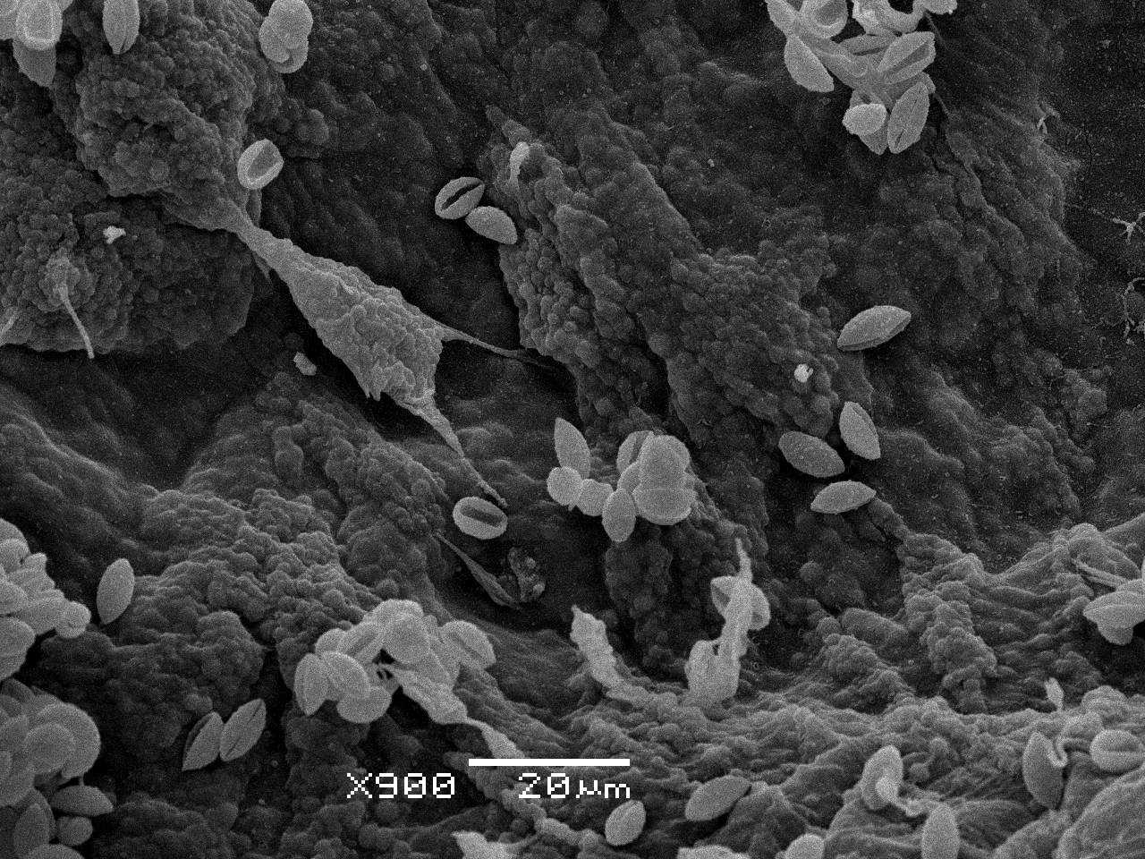 Fuligo luteonitens - внешний вид спороношений, Нелидовский, Tver Oblast (Russia)