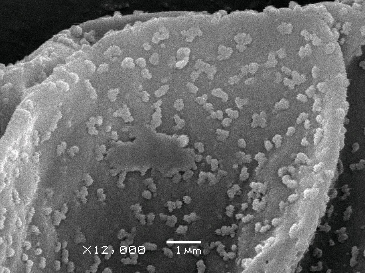 Didymium serpula - Сеть капиллиция с шаровидными пузыревидными вздутиями и спорами, СЭМ, Нелидовский, Tver Oblast (Russia)