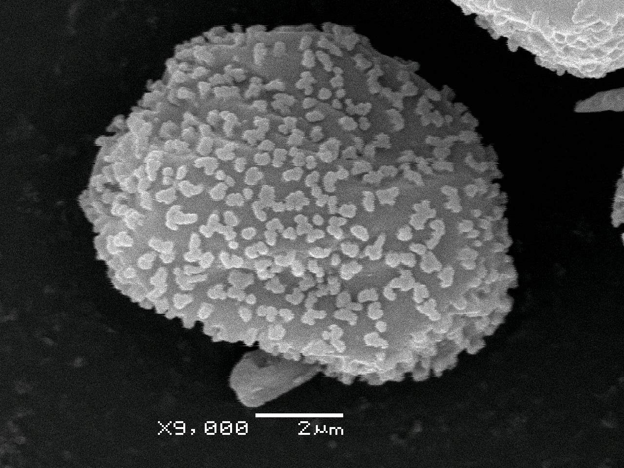Didymium serpula - Сеть капиллиция с шаровидными пузыревидными вздутиями и спорами, СЭМ, Нелидовский, Tver Oblast (Russia)