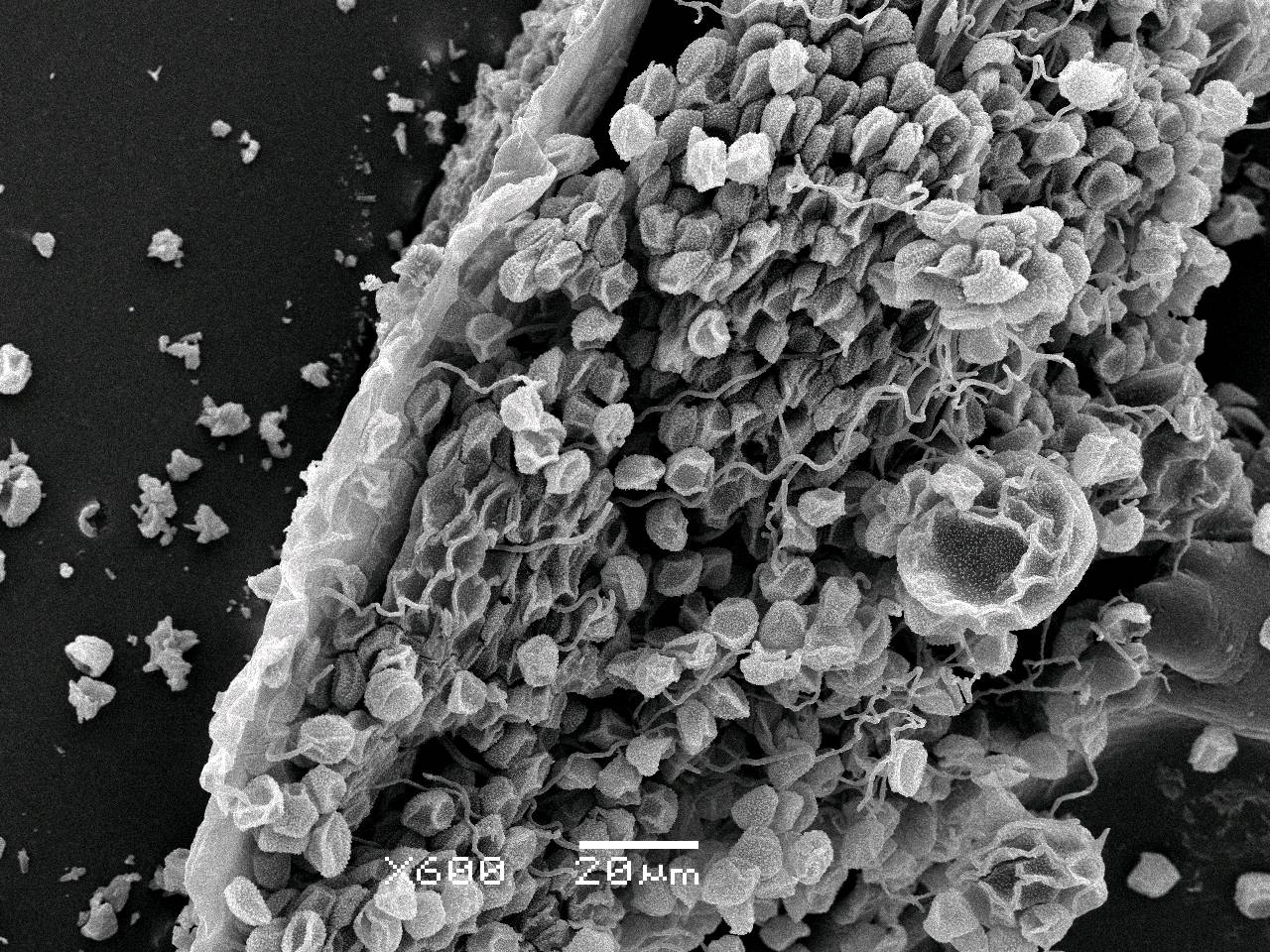 Didymium serpula - Сеть капиллиция с шаровидными пузыревидными вздутиями и спорами, СЭМ, Нелидовский, Tver Oblast (Russia)