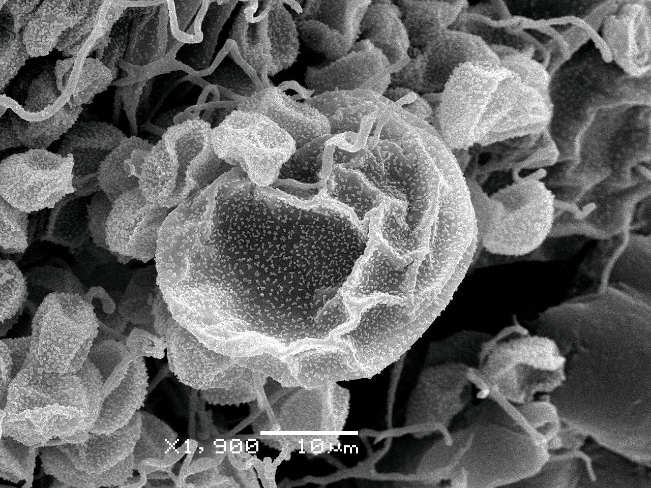 Didymium serpula - Сеть капиллиция с шаровидными пузыревидными вздутиями и спорами, СЭМ, Нелидовский, Tver Oblast (Russia)