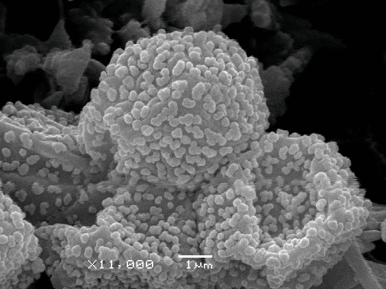 Didymium anellus - Споры, СЭМ, Нелидовский, Tver Oblast (Russia)