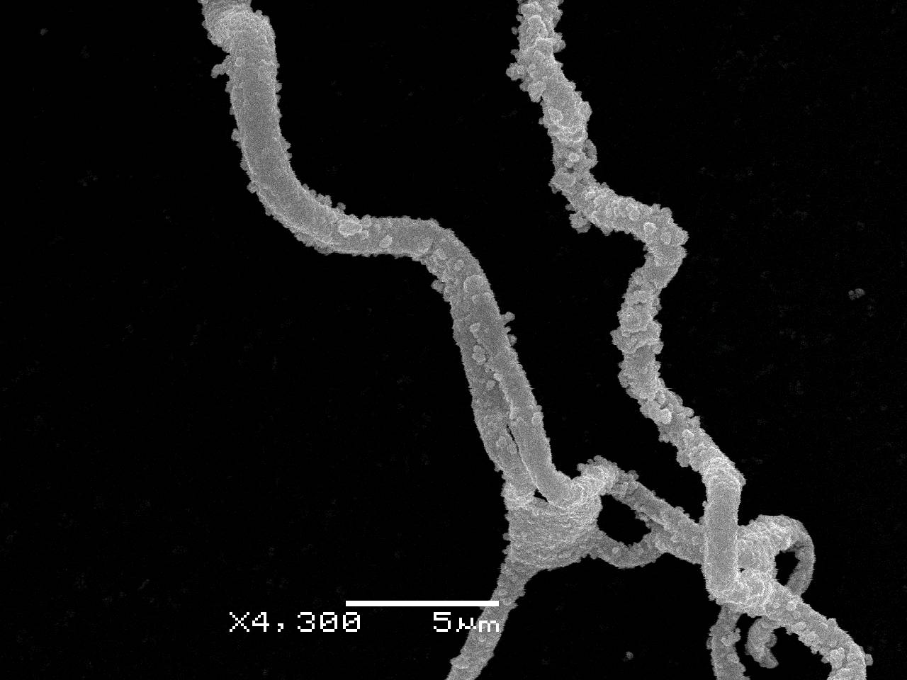 Didymium anellus - Споры, СЭМ, Нелидовский, Tver Oblast (Russia)