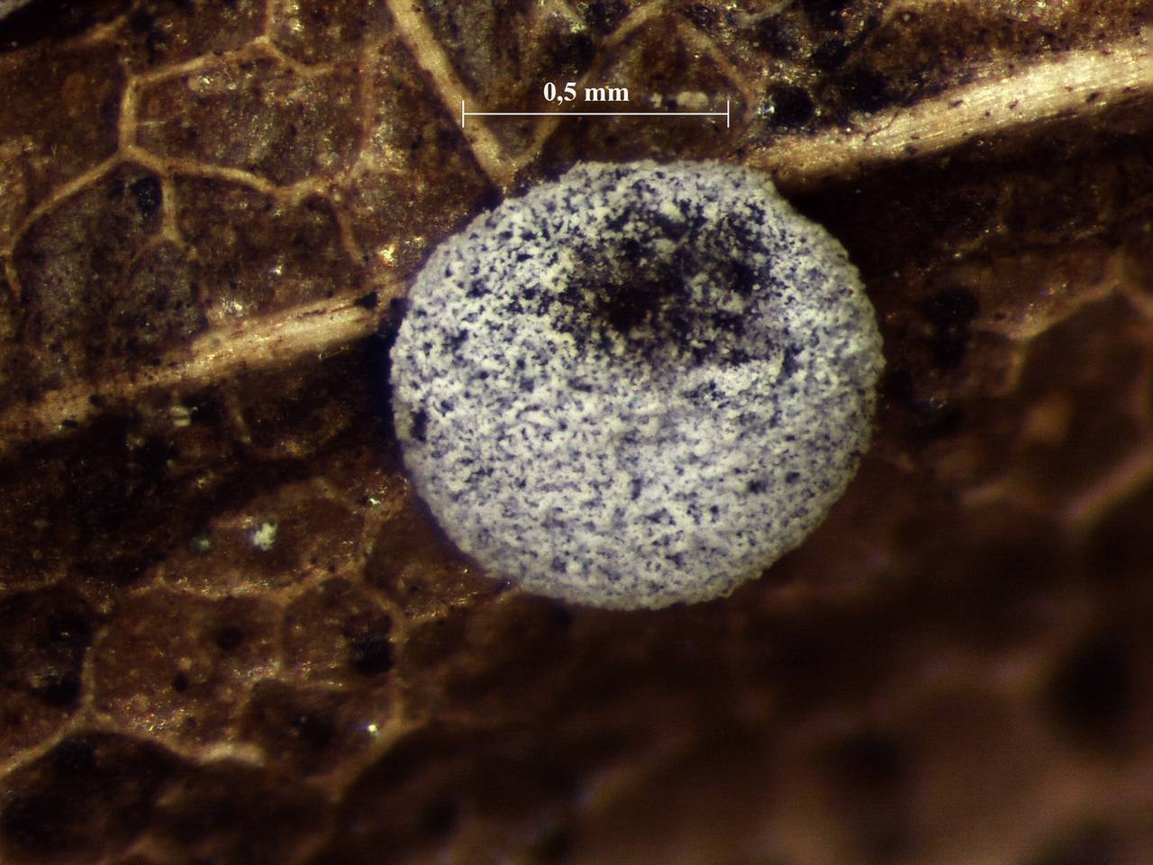 Didymium anellus - Споры, СЭМ, Нелидовский, Tver Oblast (Russia)