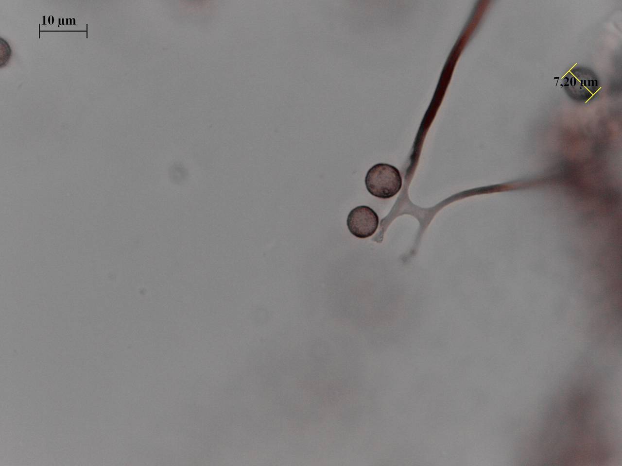 Didymium anellus - Споры, СЭМ, Нелидовский, Tver Oblast (Russia)