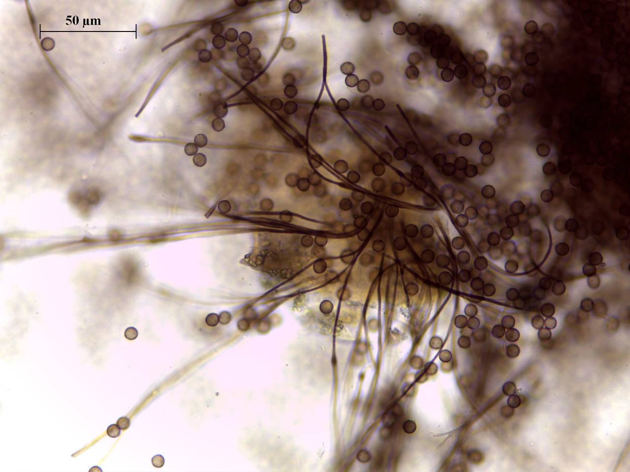 Didymium anellus - Споры, СЭМ, Нелидовский, Tver Oblast (Russia)