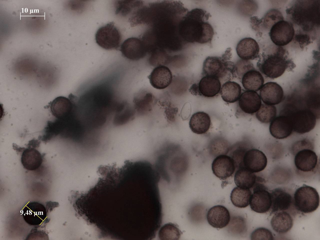 Physarum pulcherrimum - споры × 1000, Нелидовский, Tver Oblast (Russia)